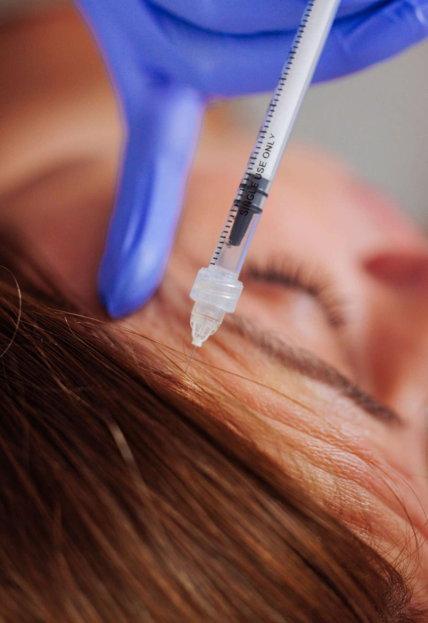 Dermal Fillers